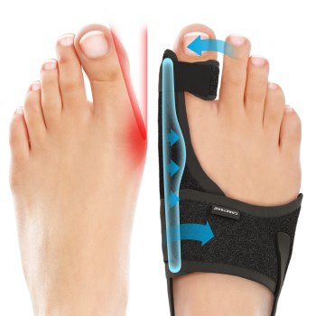 Caretras Bunion Corrector Splint